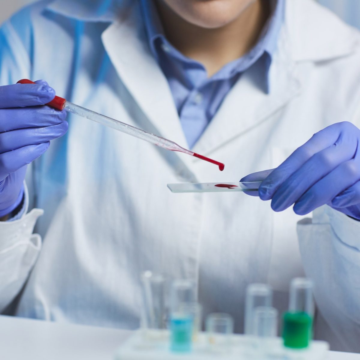 checking-sample-of-blood.jpg